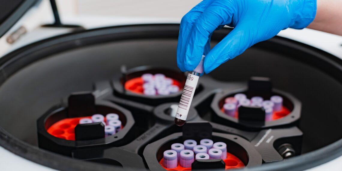 BBG fertigt explosionsgeschützte Werkzeuge für Polyurethan-Hartschaum