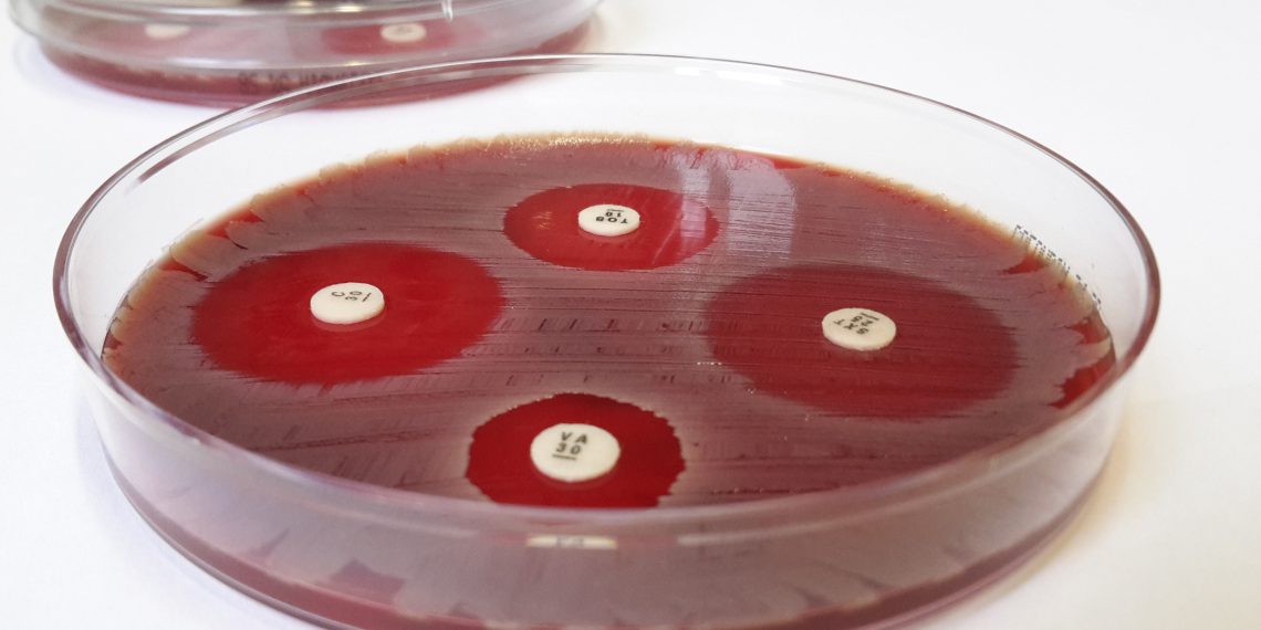 Der Plättchentest macht Antibiotika-Resistenzen sichtbar. Bild: Fabian Grein/DZIF