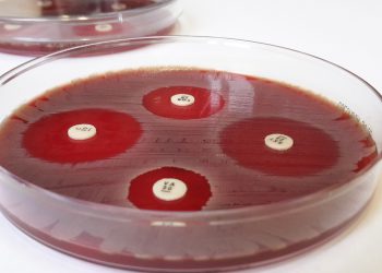 Der Plättchentest macht Antibiotika-Resistenzen sichtbar. Bild: Fabian Grein/DZIF